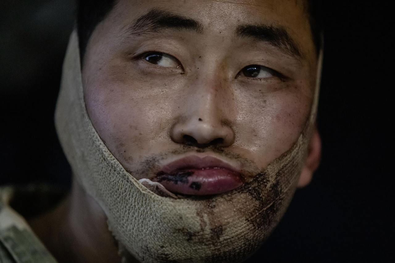 8044176-2 ▲▼2名北韓士兵在庫斯克州作戰遭到烏軍俘虜,送往基輔接受審訊與治療。(圖/達志影像)