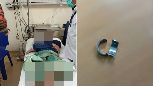 8071981 ▲▼GG套戒指卡死!鐵剪「喀擦」一聲 消防員傻眼:差點壞掉。(圖/翻攝亞羅士打消拯局)