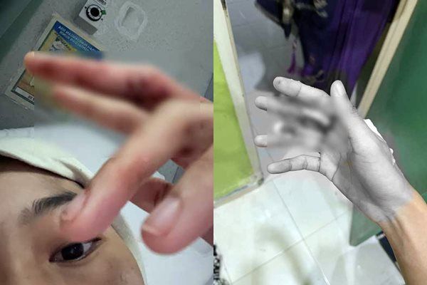 d8091679 ▲▼貝拉在家中如廁時,突遭巨蟒攻擊、大腿被咬,她徒手與蟒蛇搏鬥後手部受傷。(圖/翻攝自Facebook)