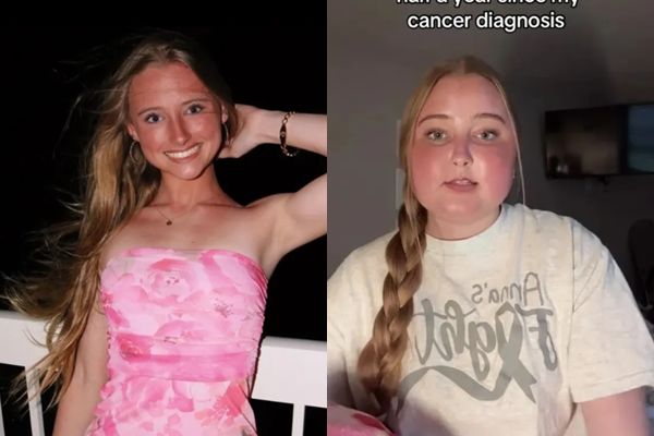 8233600-1 ▲▼19歲正妹網美患腦癌!臉腫成2倍嚴重變形 不到1年病逝。(圖/Instagram/pheelan.anna)