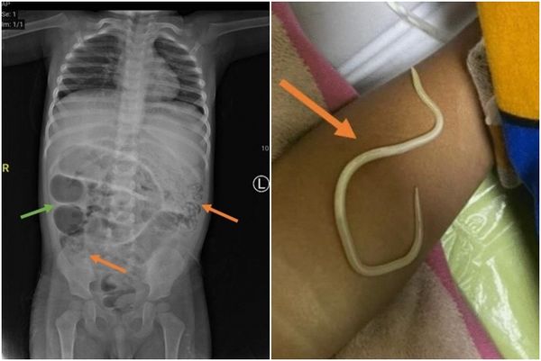 d8168822 ▲▼ 。(圖/翻攝自Journal of Medical Case Reports)