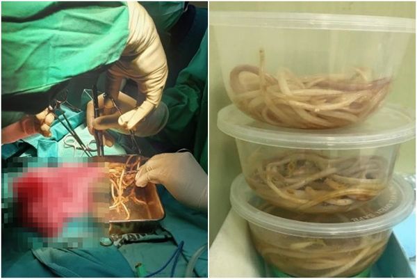 d8168823 ▲▼ 。(圖/翻攝自Journal of Medical Case Reports)