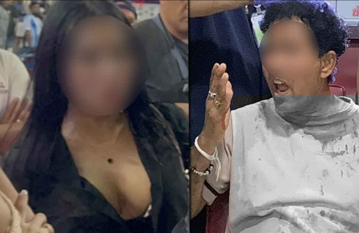 8241599-1 ▲▼賣淫女雌雄難辨!他摸下體驗貨「驚覺有GG」 反悔卻遭變性人暴打。(圖/翻攝自khaosod)