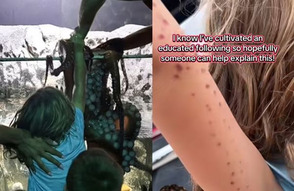 6歲童水族館被巨型章魚吸住　「3個大人才拔開」滿手瘀傷畫面曝。（圖／翻攝自TikTok／britneytaryn）