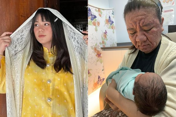 d8358289-1 ▲▼大馬女子法拉(Farah Faizal)懷孕後荷爾蒙變化導致她滿臉痘痘、鼻子腫大。(圖/翻攝自X、IG)