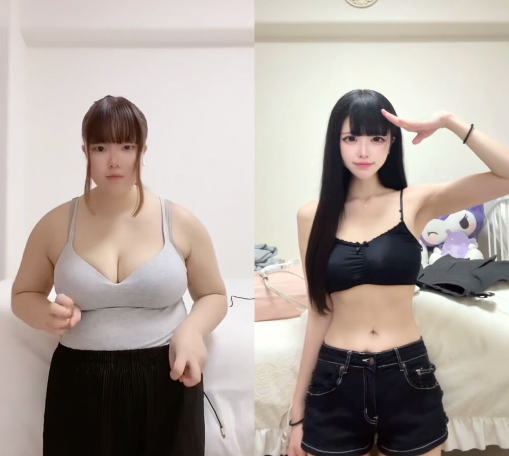 8612991 ▲抖音網紅rori0714分享自己整形前後對比。(圖/翻攝抖音)