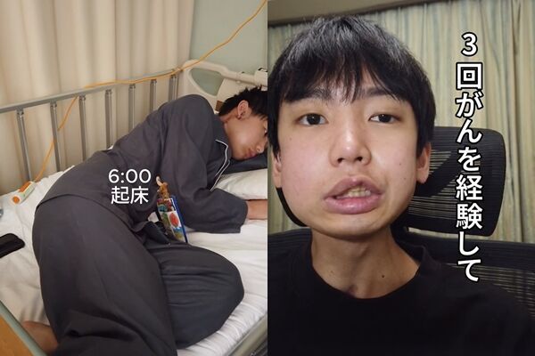 8617338 ▲▼男大生「嘴破3周沒好」確診舌癌!。(圖/IG/nakano1224_2000)