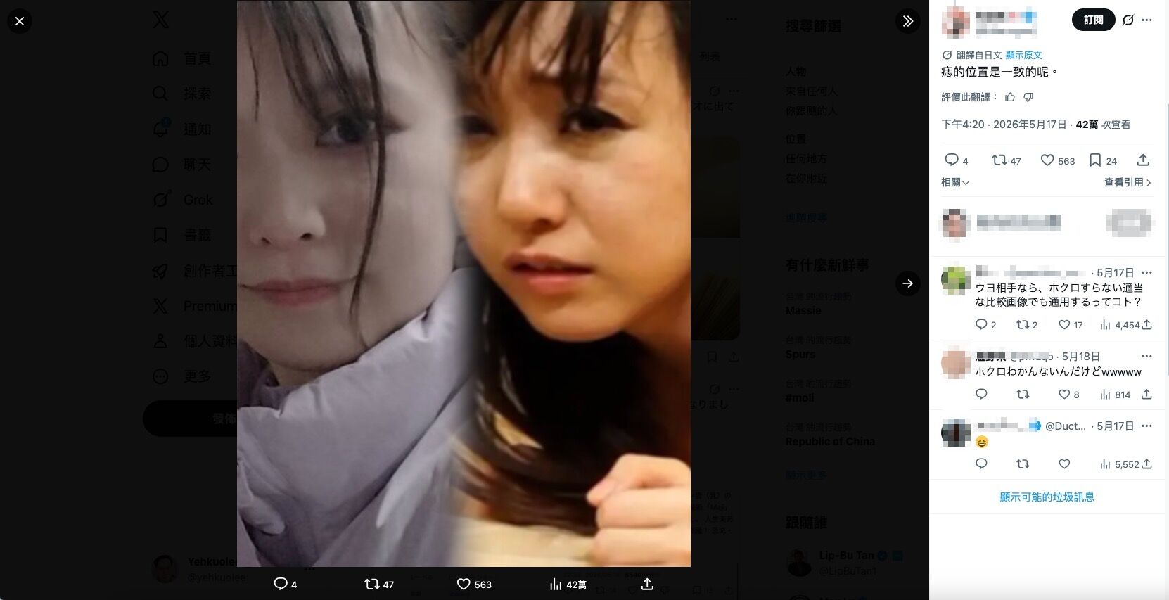 8750625 ▲▼網友比對痣的位置是一樣的。(圖/翻攝X)