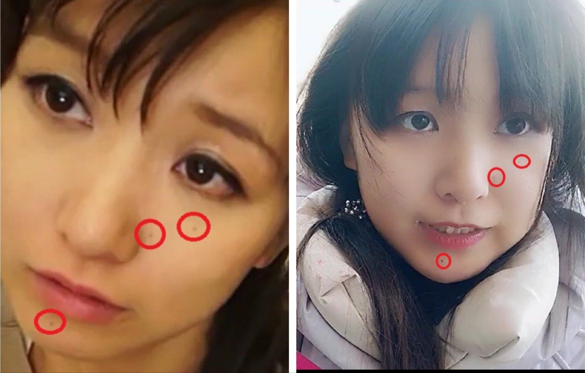 8750626 ▲▼網友比對痣的位置是一樣的。(圖/翻攝X)