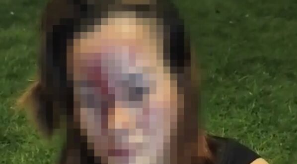 ▲▼路邊惡煞突拿「榴槤殼」狂砸！　泰女慢跑竟被打到滿臉血。（圖／翻攝thairath.co.th）